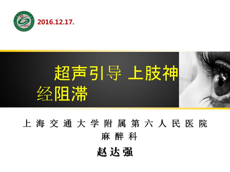 赵达强超声引导上肢神经阻滞.ppt_第1页