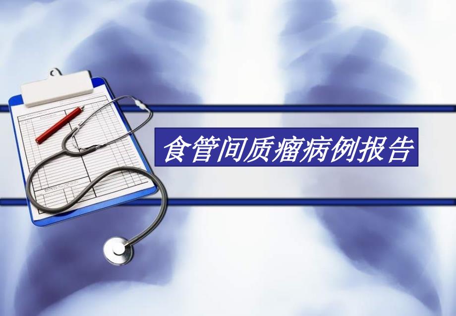 食管间质瘤PPT课件.pptx_第1页