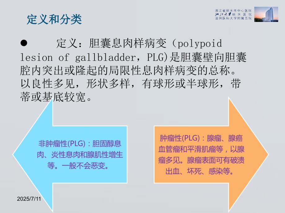 胆囊息肉外科处理思考ppt课件.ppt_第3页