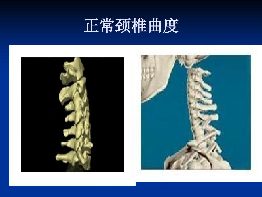 颈椎病预防与保健PPT课件.ppt_第3页