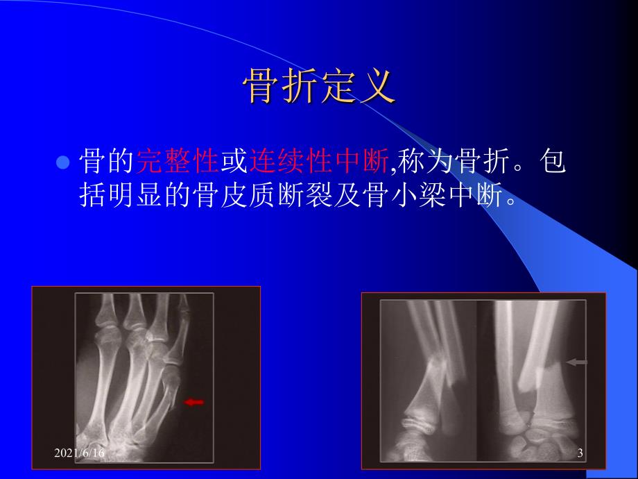 骨科课件PPT课件.ppt_第3页