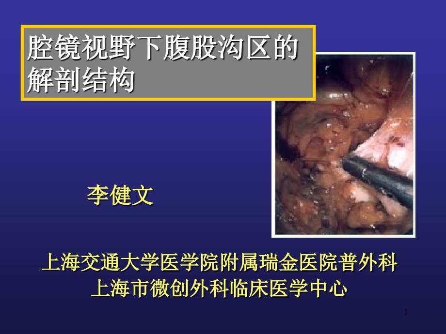 腔镜下腹股沟区的解剖.ppt_第1页