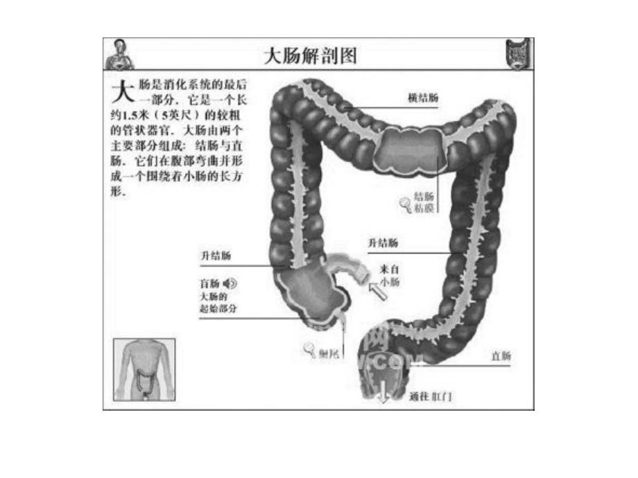 结肠息肉PPT课件.ppt_第2页