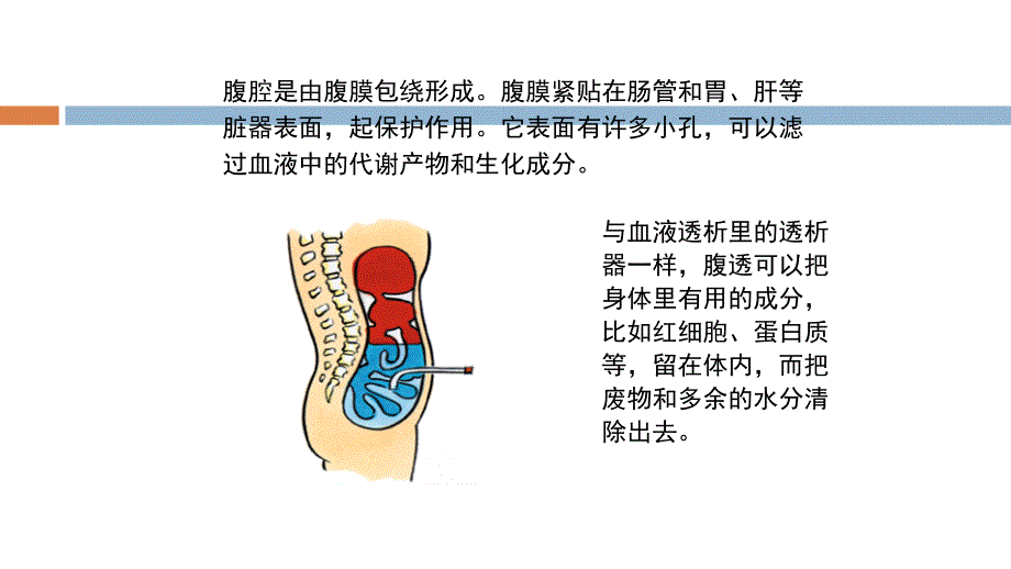 腹膜透析术前术后护理.ppt_第3页