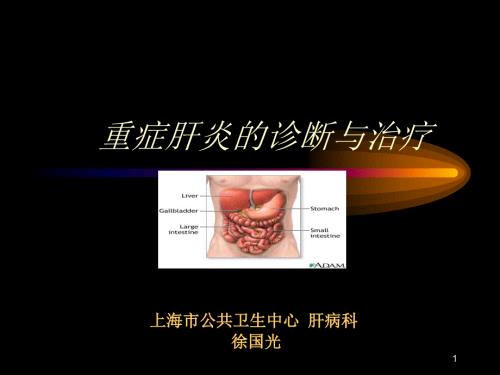 重症肝炎的诊断与治疗.ppt