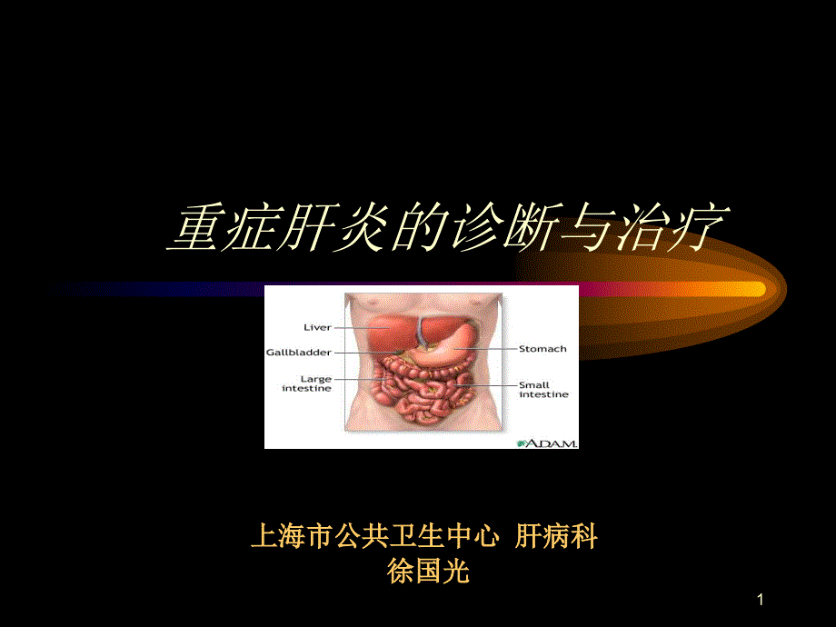 重症肝炎的诊断与治疗.ppt_第1页