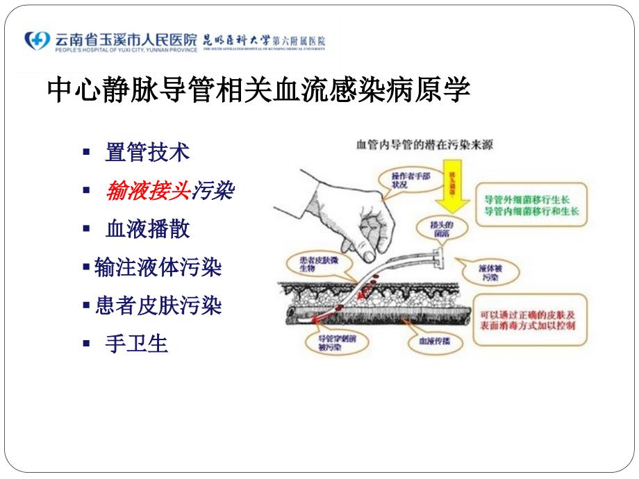 输液接头的日常维护与更换.pptx_第3页