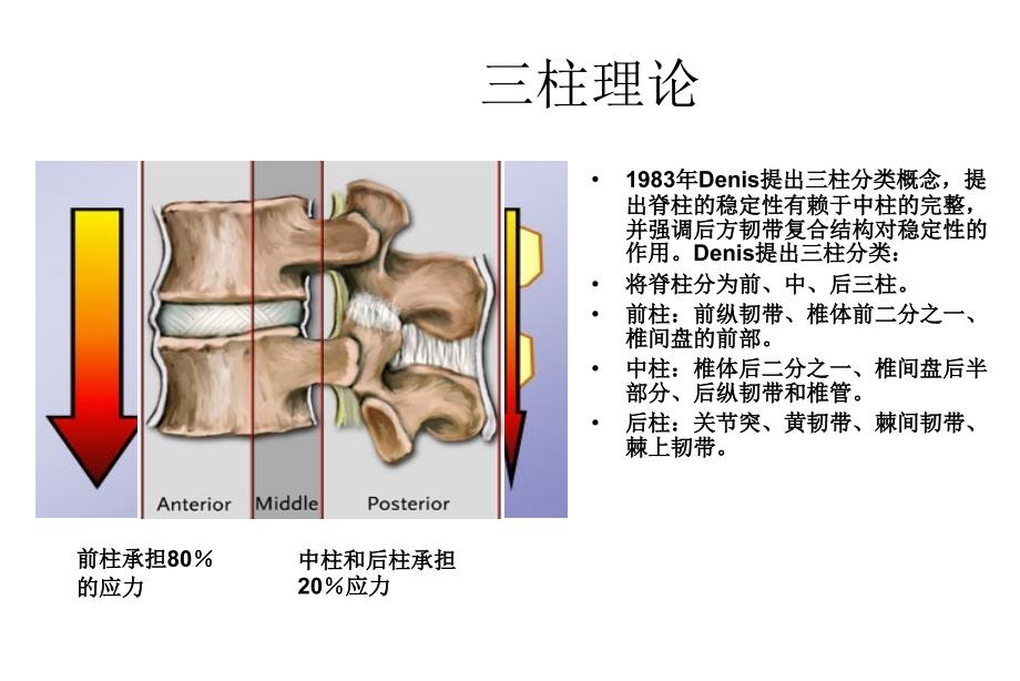 脊柱内固定原理.ppt_第3页