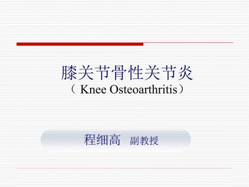膝关节骨性关节炎.ppt