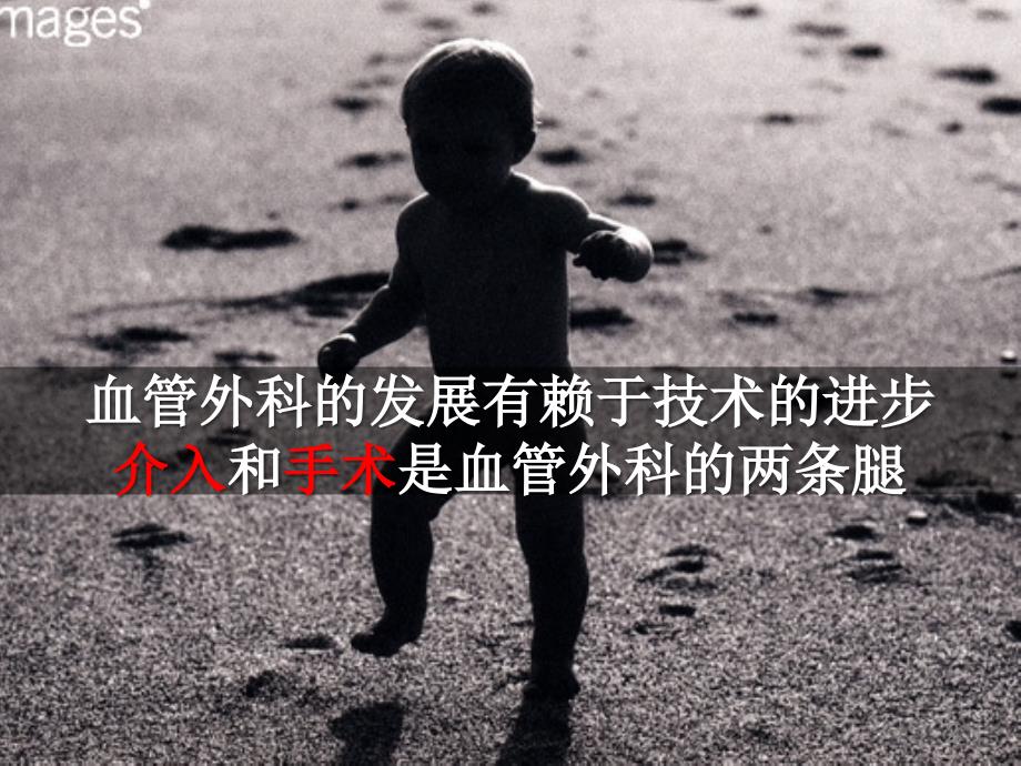 血管外科手术介入治疗基础知识课件.pptx_第2页