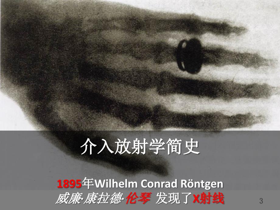 血管外科手术介入治疗基础知识课件.pptx_第3页