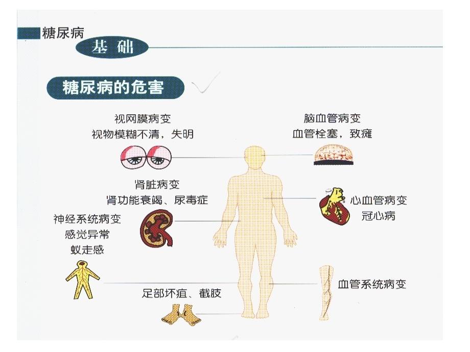 糖尿病与脑梗塞PPT课件.ppt_第2页