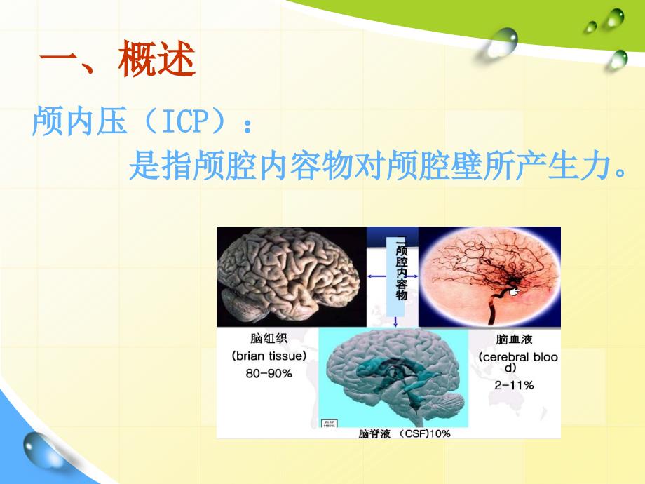 颅内压增高的护理PPT课件.ppt_第2页