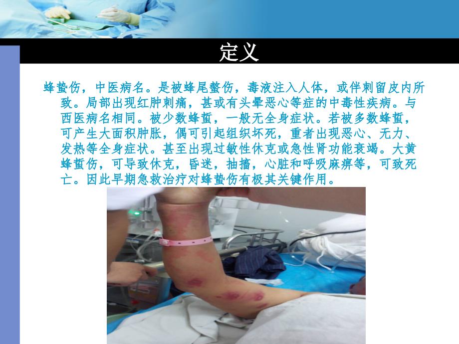 蜂蛰伤的急救与护理.ppt_第3页