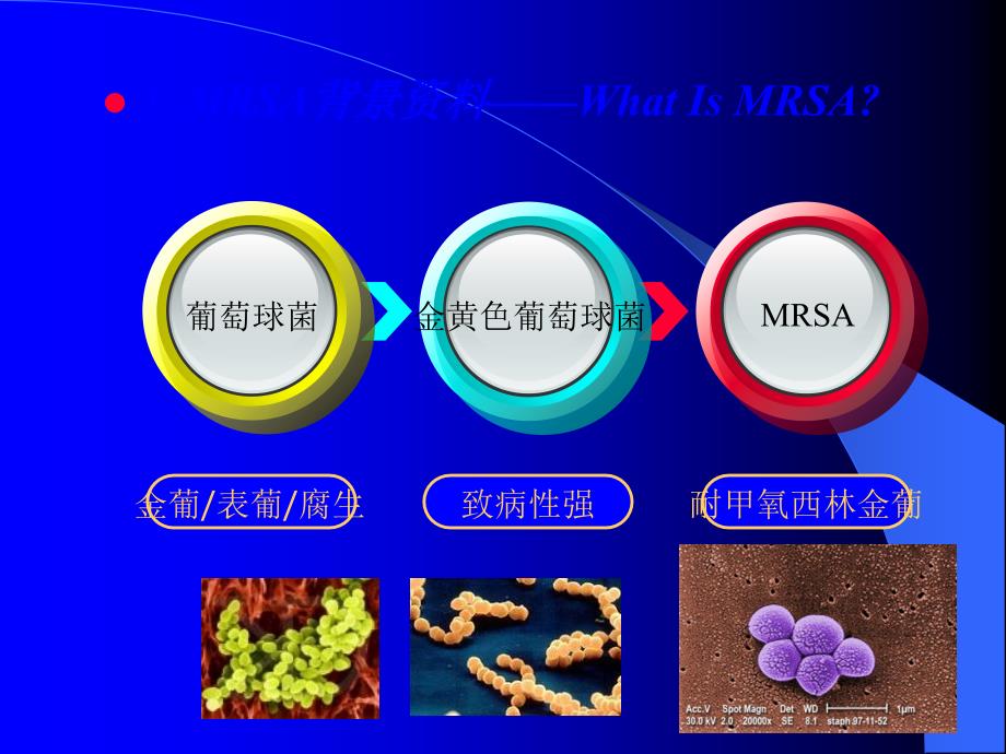 耐甲氧西林金黄色葡萄球菌MRSA检测荧光PCR法.ppt_第2页