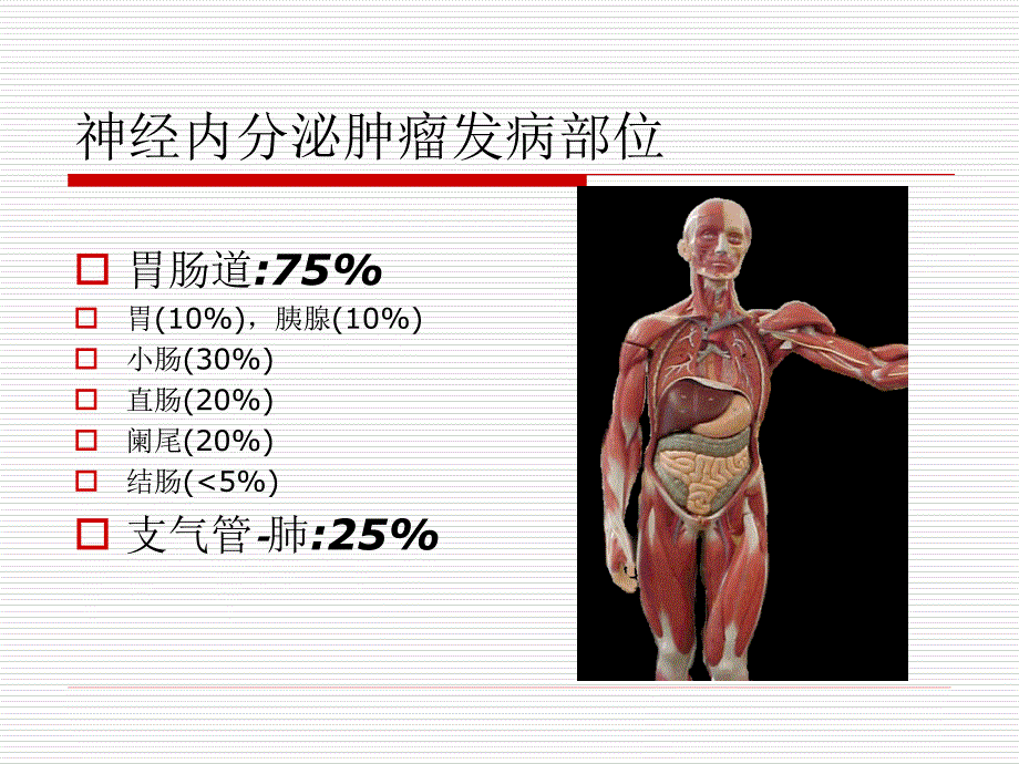 胃肠胰神经内分泌肿瘤的诊断与治疗郭仁宏.ppt_第3页