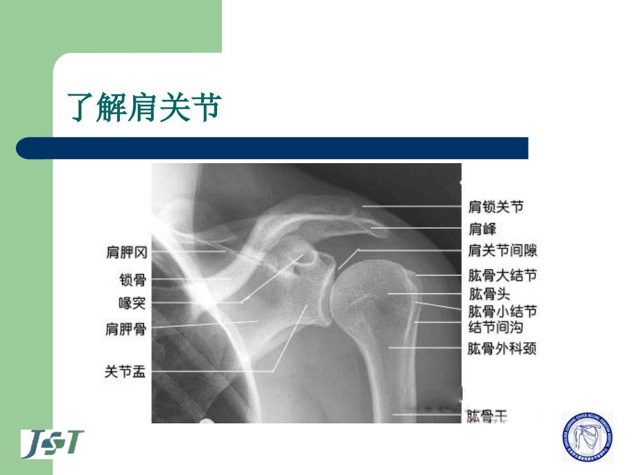 肩关节镜术后的康复图文.ppt_第3页