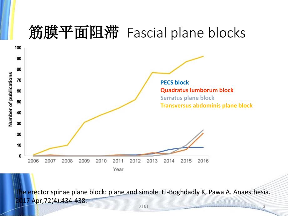 超声引导下竖脊肌阻滞在临床应用.ppt_第3页