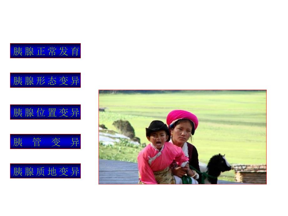 胰腺解剖变异与相关疾病.ppt_第2页