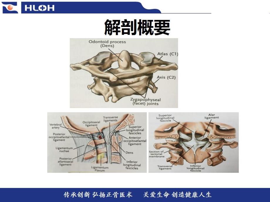 齿状突骨折的分型和微创治疗手术方法的正确选择.ppt_第2页