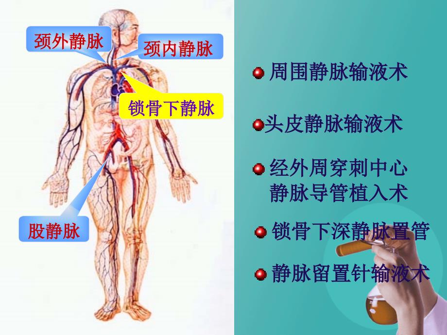 静脉留置针的护理PPT课件.ppt_第2页