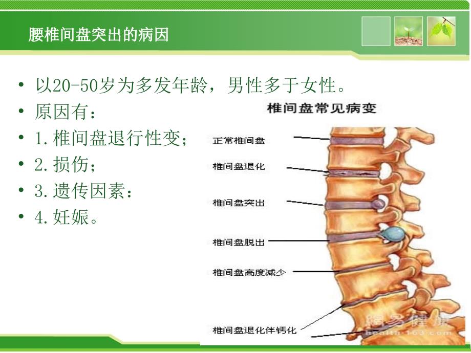 腰椎间盘突出的健康教育PPT课件.ppt_第2页