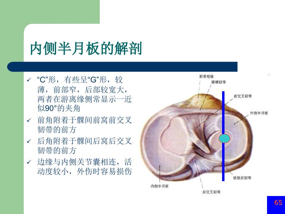 膝关节半月板损伤MRI诊断ppt.ppt_第2页