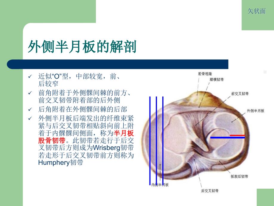 膝关节半月板损伤MRI诊断ppt.ppt_第3页