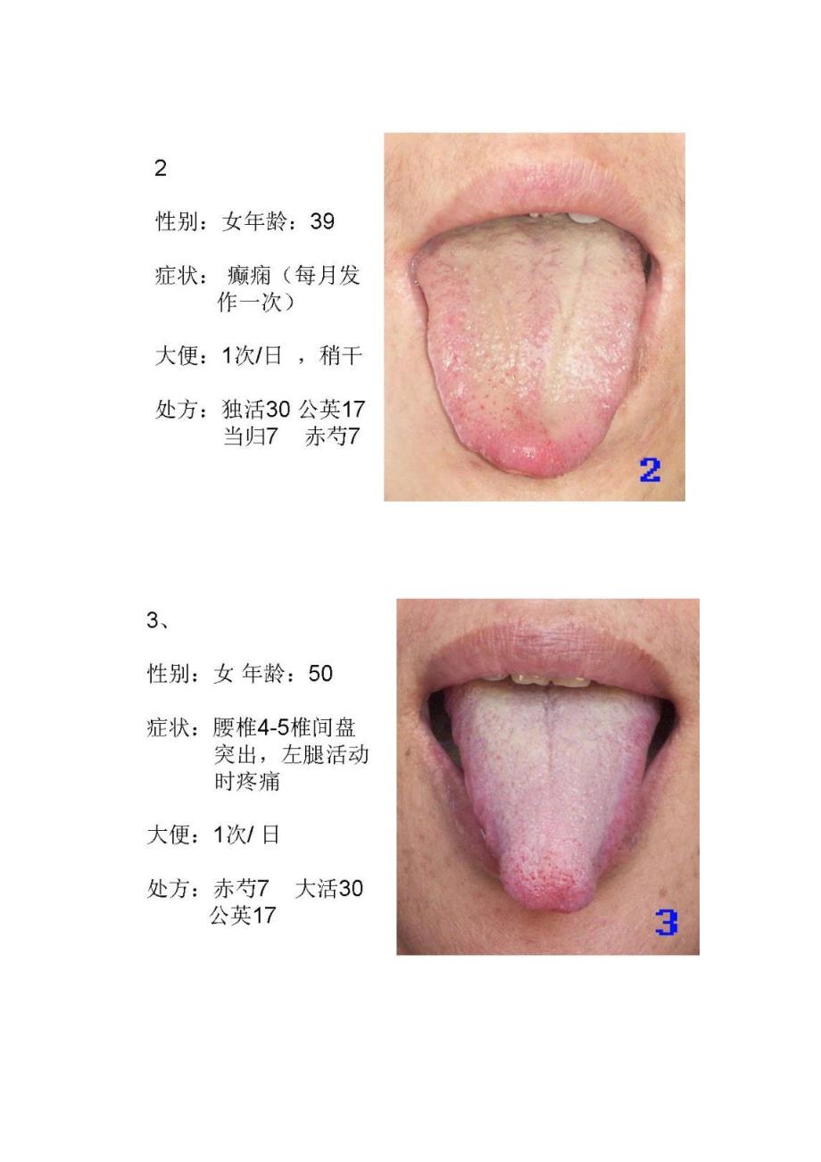 舌诊处方示例集合100例.docx_第2页