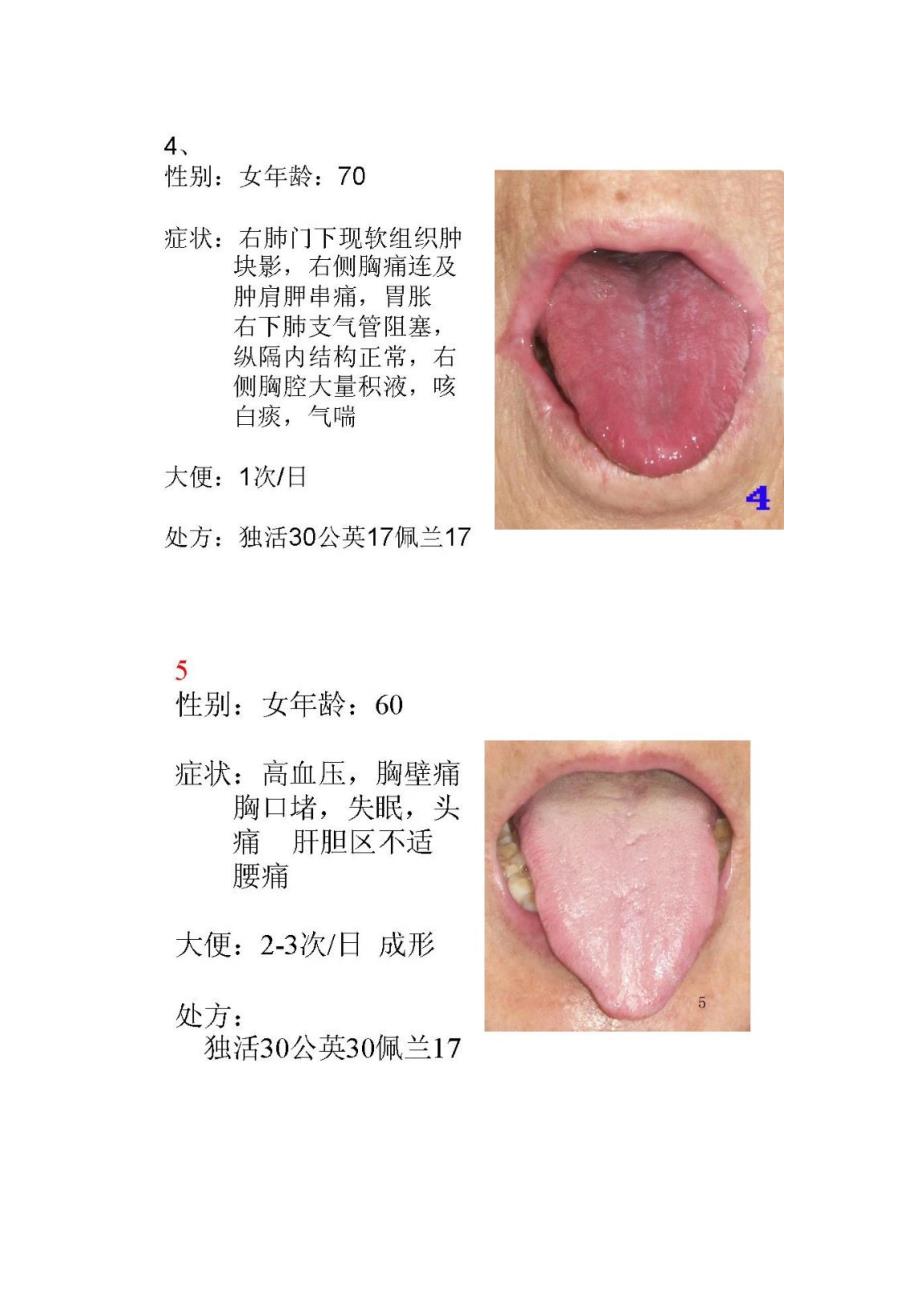 舌诊处方示例集合100例.docx_第3页