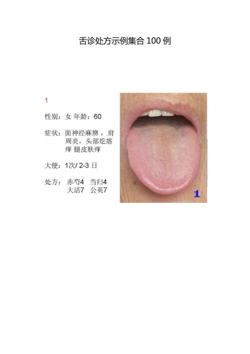 舌诊处方示例集合100例.docx