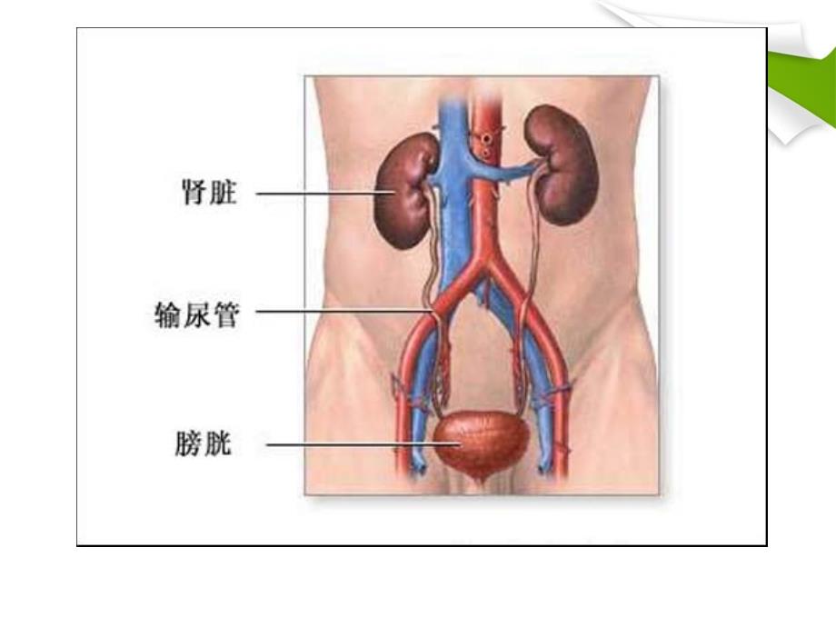 膀胱肿瘤的护理PPT课件.ppt_第3页