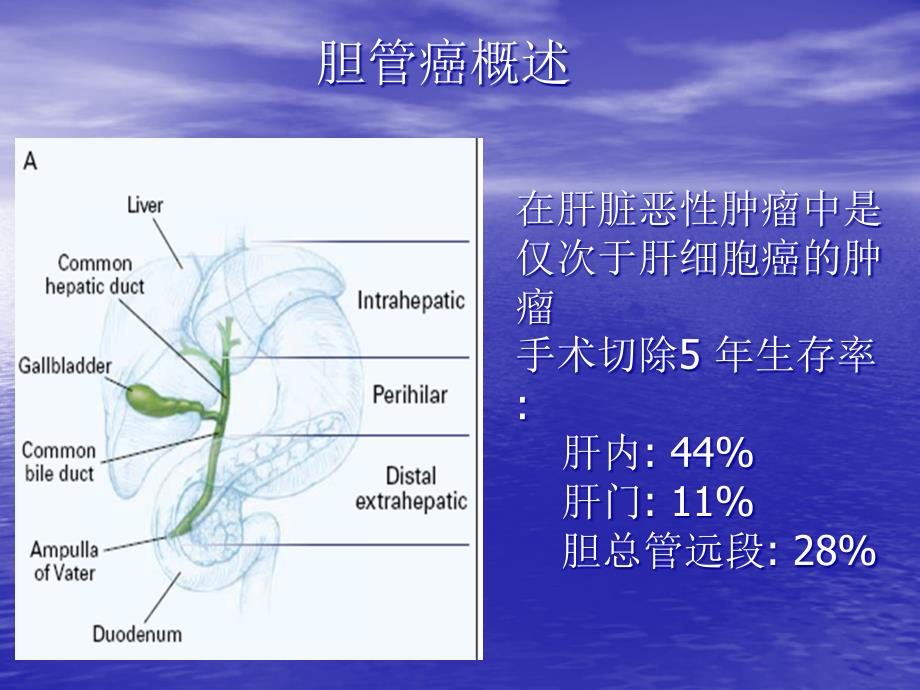 胆管癌的CT诊断.ppt_第2页