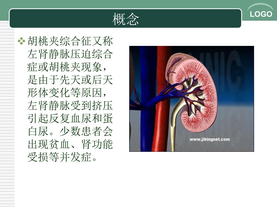 胡桃夹综合征PPT课件.ppt_第2页