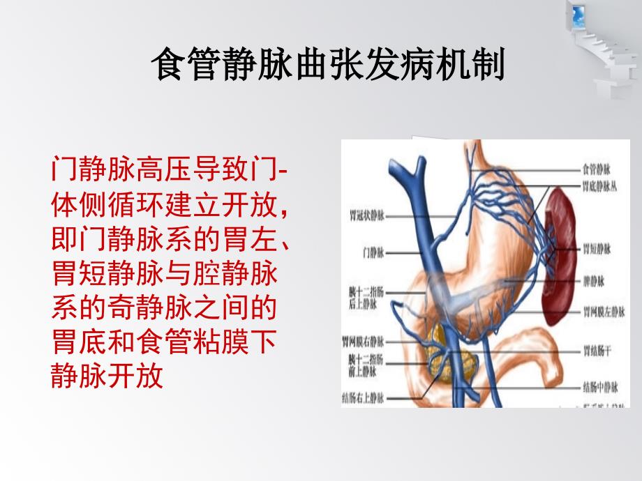 食管胃底静脉曲张治疗.ppt_第2页