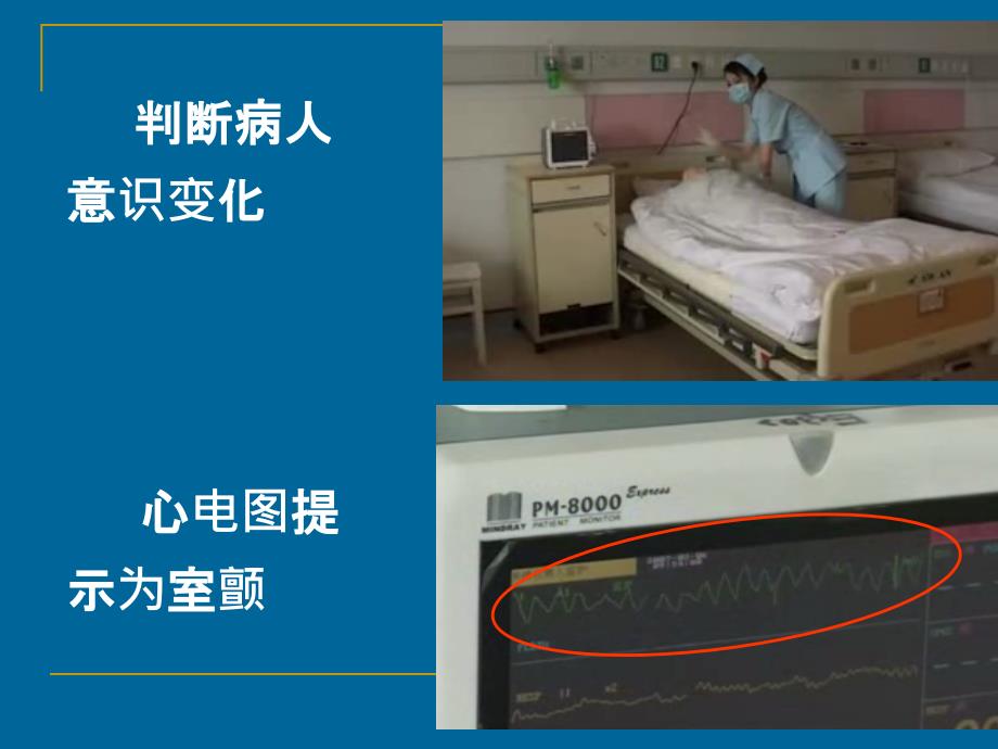 除颤仪ppt课件.ppt_第2页
