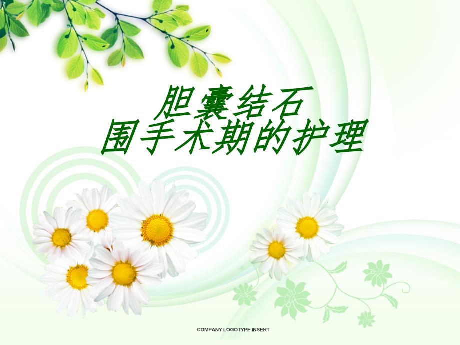 胆囊结石围手术期护理.ppt_第1页