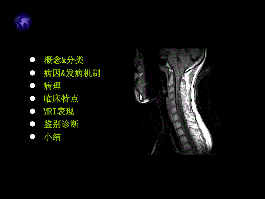 脊髓空洞症MRI表现.ppt_第2页