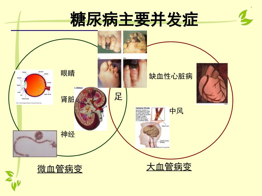 糖尿病高血压中医健康教育讲座.ppt_第3页