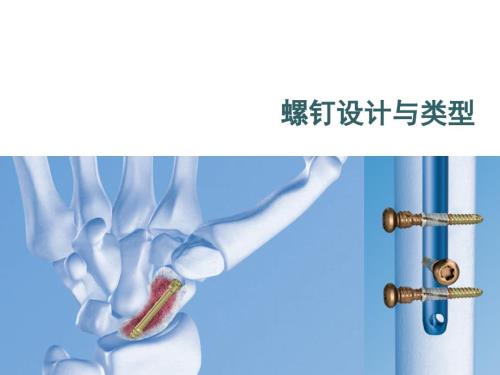 骨科基础螺钉设计与类型.ppt
