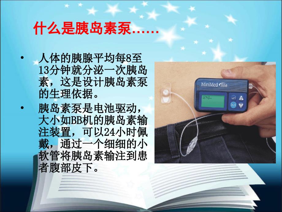 胰岛素泵的使用及护理.ppt_第3页