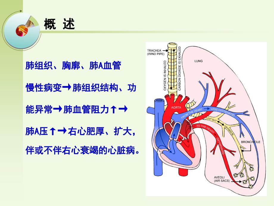 肺源性心脏病病人的护理.ppt_第2页