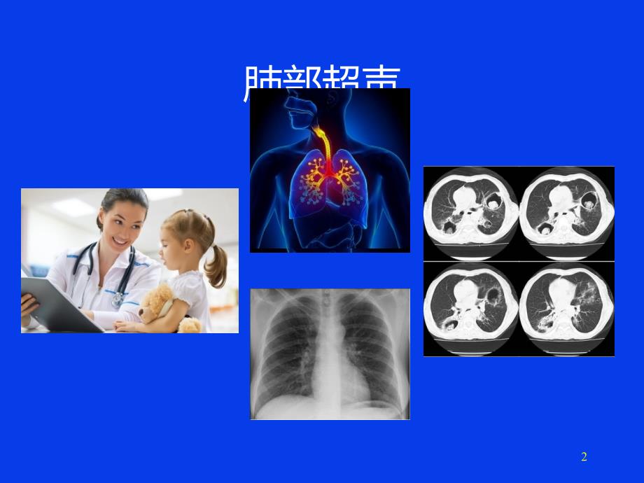 肺部超声的临床应用.ppt_第2页