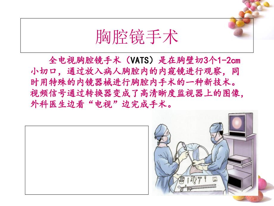 胸腔镜手术术前术后护理.ppt_第2页