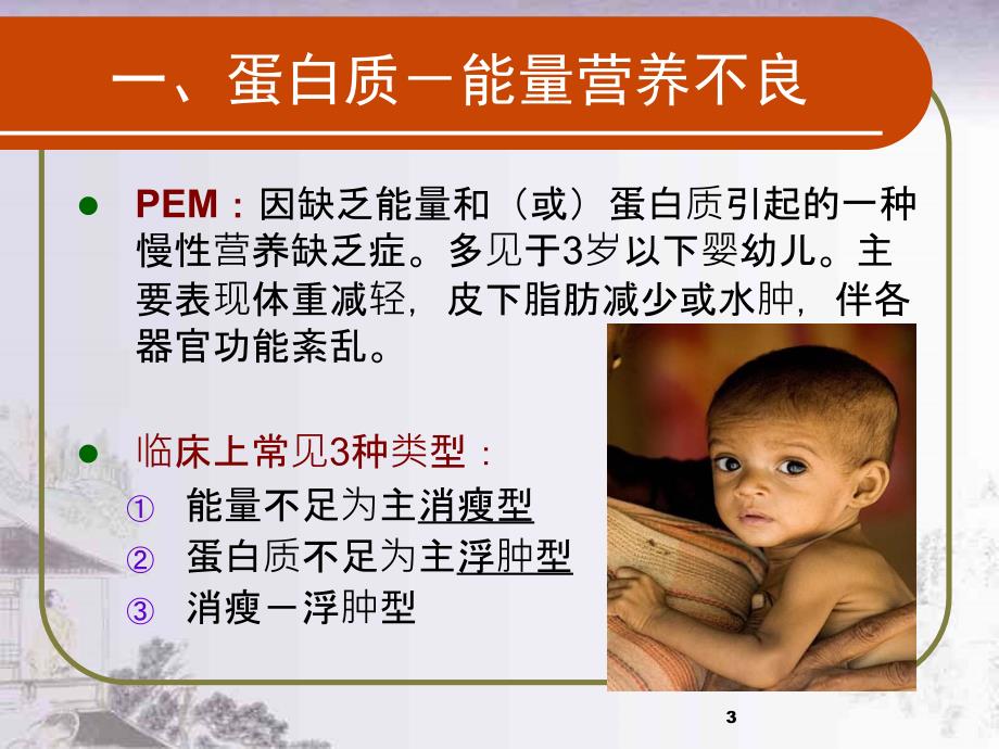 维生素D缺乏性佝偻病PPT课件.ppt_第3页