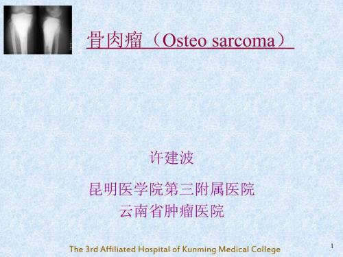 骨肉瘤OsteosarcomaPPT课件.ppt