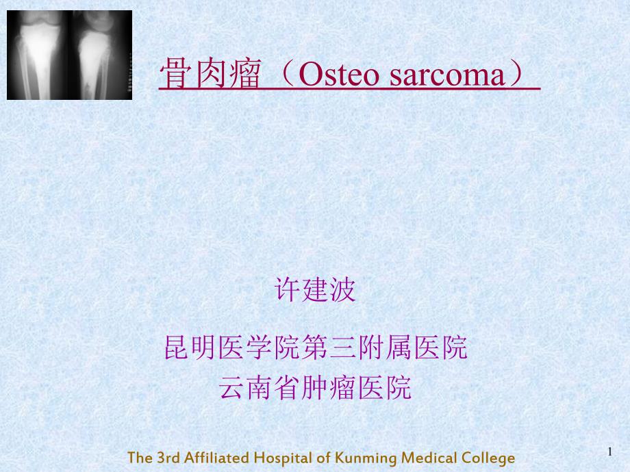 骨肉瘤OsteosarcomaPPT课件.ppt_第1页