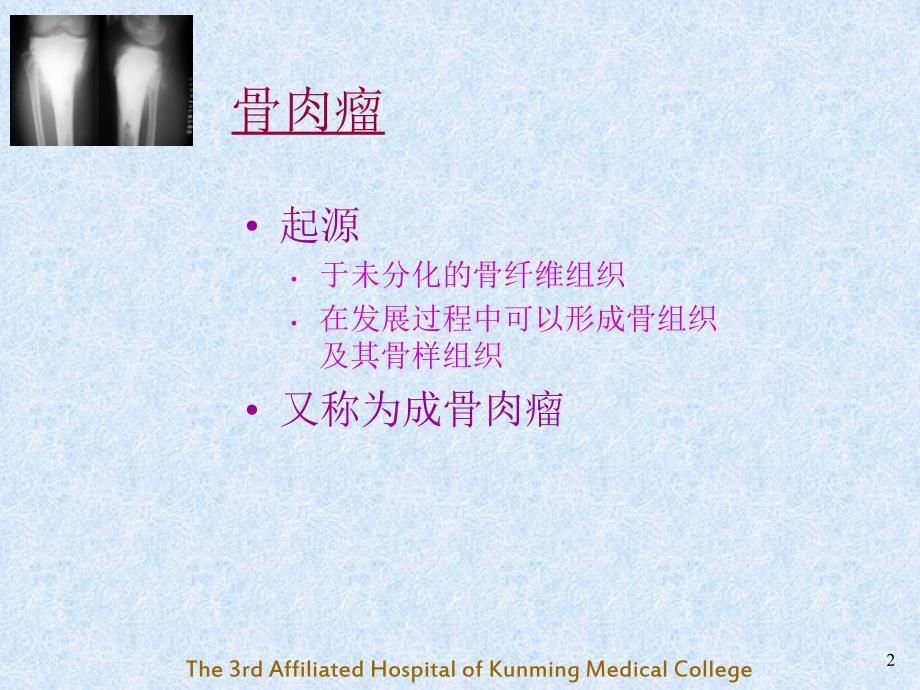 骨肉瘤OsteosarcomaPPT课件.ppt_第2页
