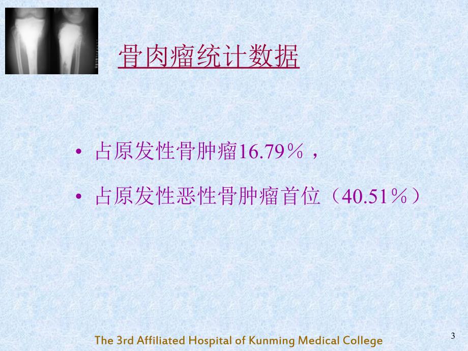 骨肉瘤OsteosarcomaPPT课件.ppt_第3页