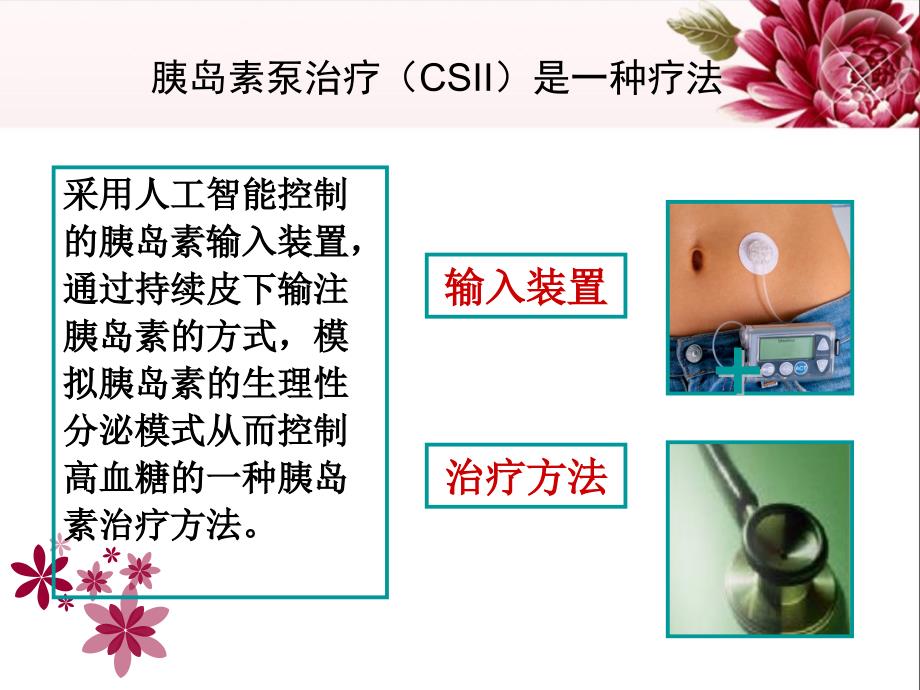 胰岛素泵的规范使用王颖.ppt_第2页